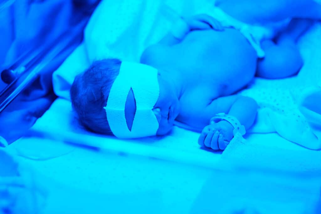 Gelbsucht bei Babys dr. Grässl